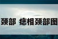 痣相颈部 痣相颈部图片女